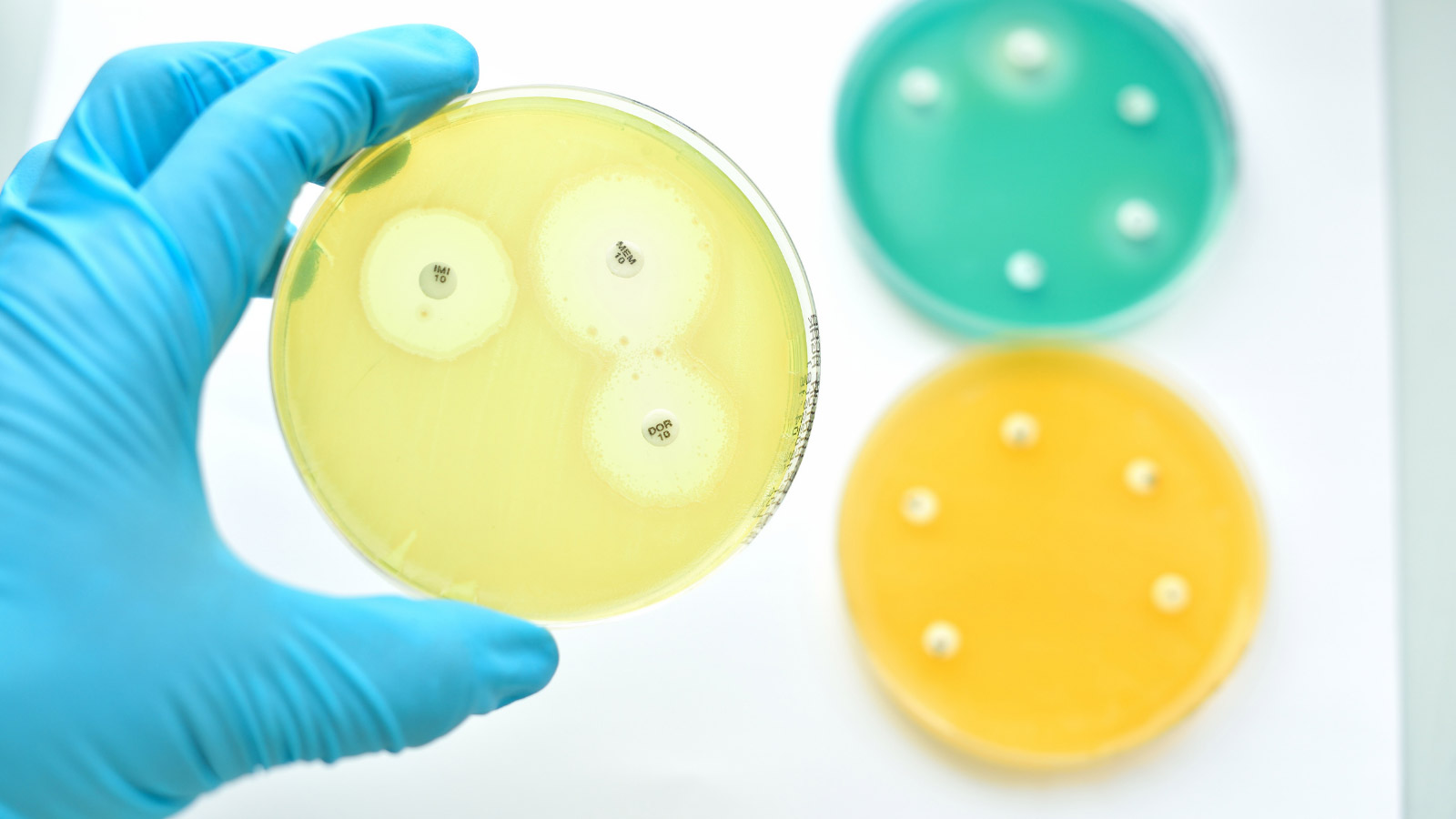 apid detection and effective infection control system for antimicrobial resistance