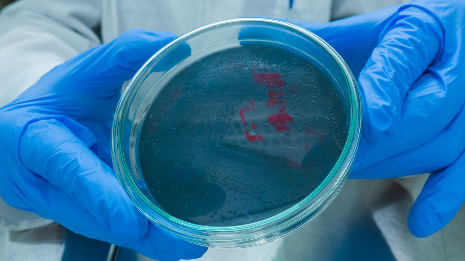 apid detection and effective infection control system for antimicrobial resistance